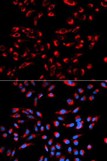 C1QBP Antibody in Immunocytochemistry (ICC/IF)