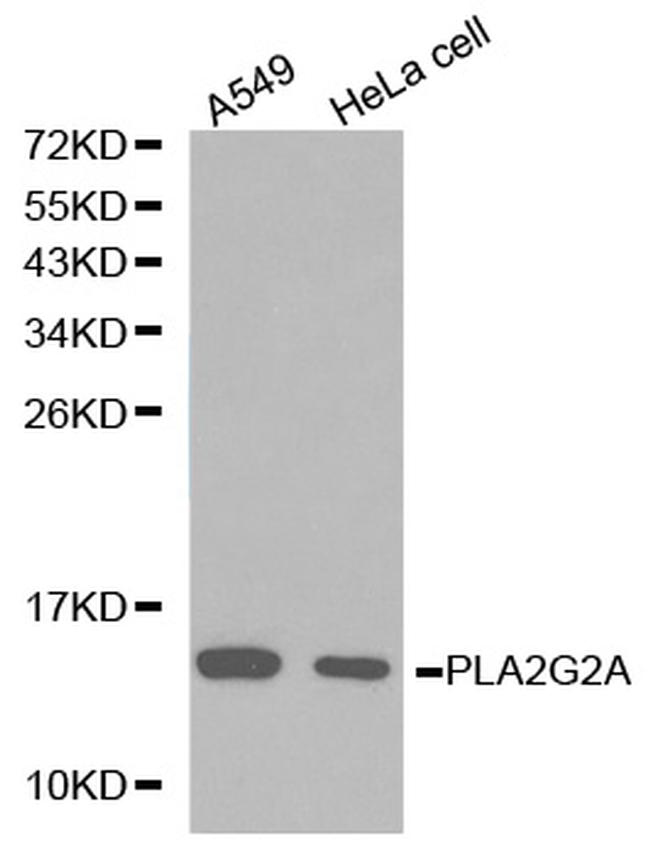 PLA2G2A Antibody in Western Blot (WB)