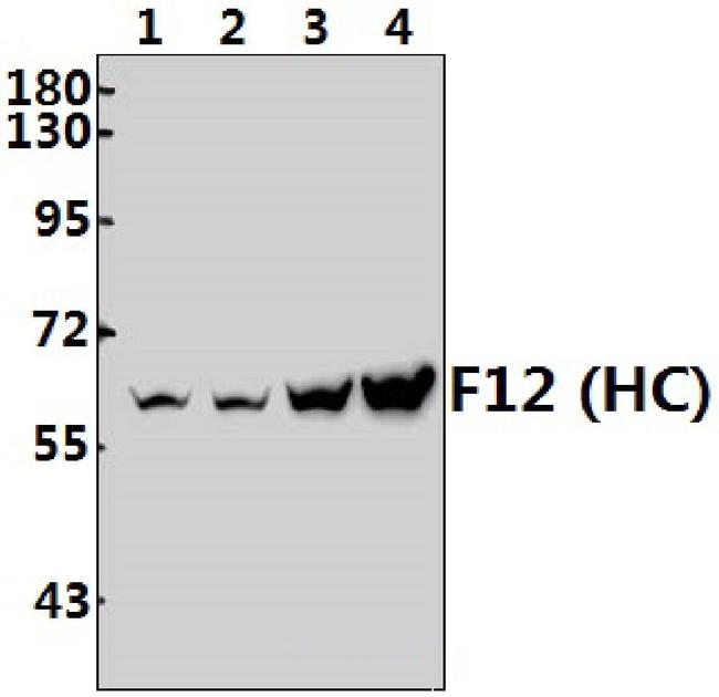 Factor XII Heavy chain Antibody in Western Blot (WB)