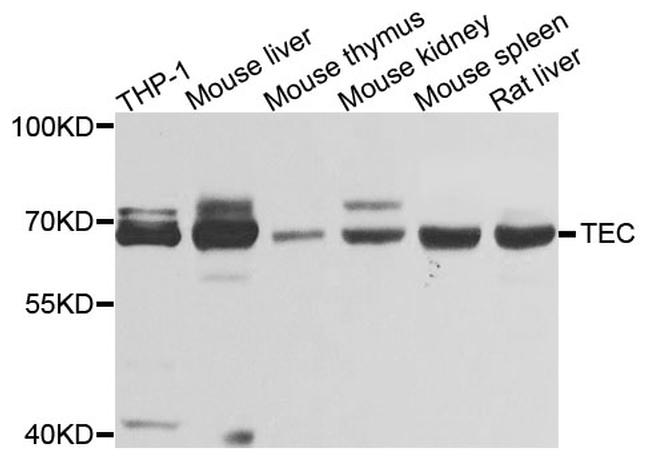 TEC Antibody in Western Blot (WB)