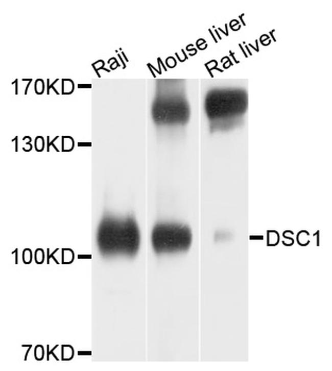 DSC1 Antibody in Western Blot (WB)