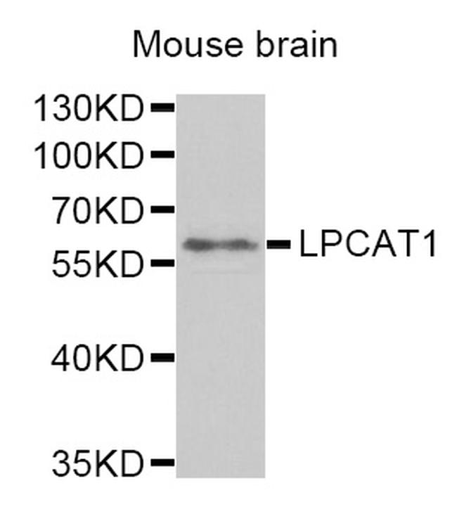 LPCAT1 Antibody in Western Blot (WB)