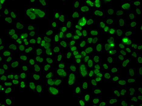 PLCXD2 Antibody in Immunocytochemistry (ICC/IF)