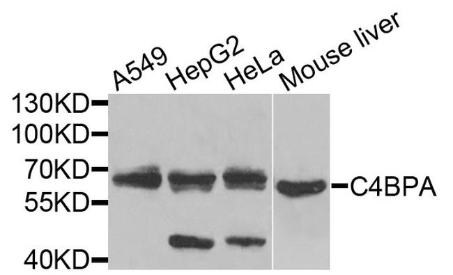 C4BPA Antibody in Western Blot (WB)