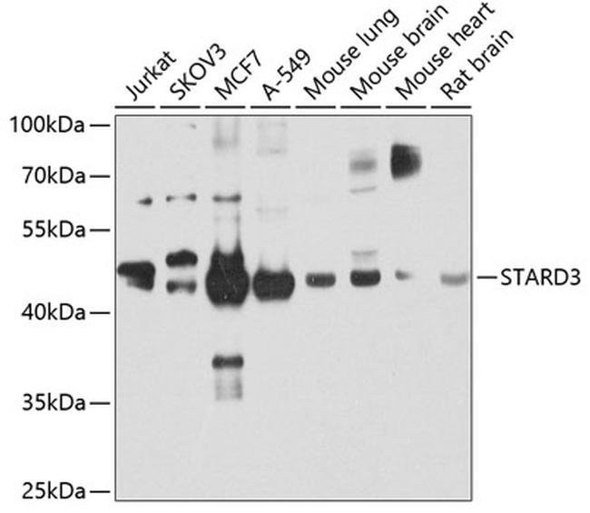 STARD3 Antibody in Western Blot (WB)