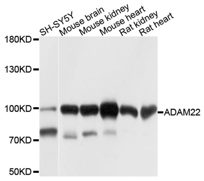 ADAM22 Antibody in Western Blot (WB)