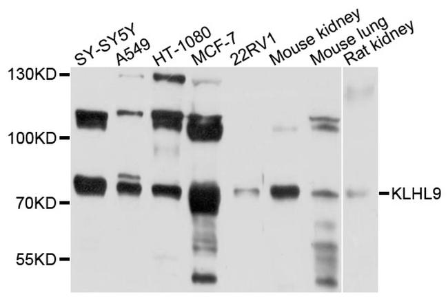 KLHL9 Antibody in Western Blot (WB)