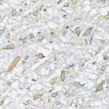 SPICE1 Antibody in Immunohistochemistry (Paraffin) (IHC (P))