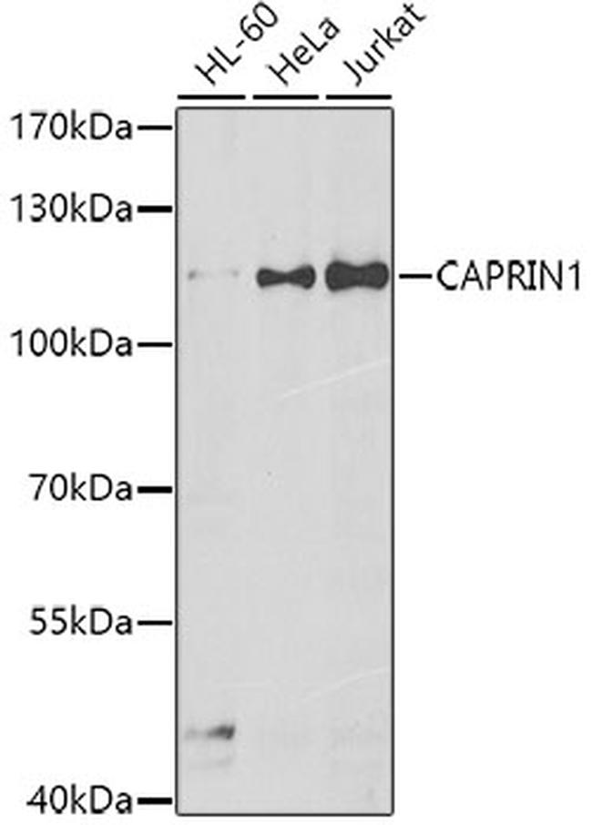 GPIP137 Antibody in Western Blot (WB)