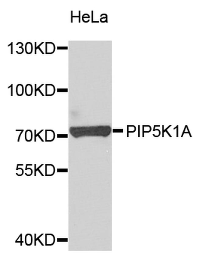 PIP5K1A Antibody in Western Blot (WB)