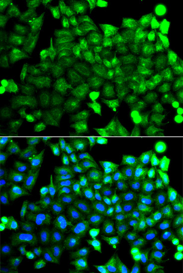 NCALD Antibody in Immunocytochemistry (ICC/IF)