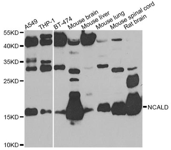 NCALD Antibody in Western Blot (WB)