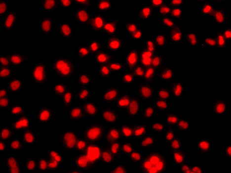 PRICKLE2 Antibody in Immunocytochemistry (ICC/IF)