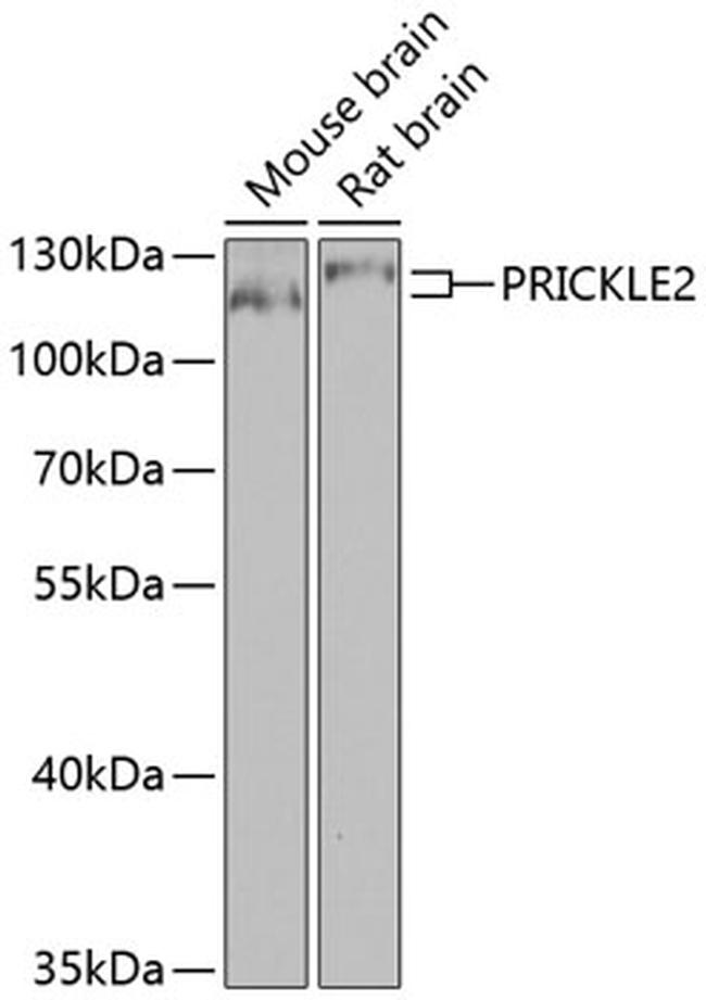 PRICKLE2 Antibody in Western Blot (WB)