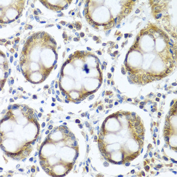 IFI44 Antibody in Immunohistochemistry (Paraffin) (IHC (P))