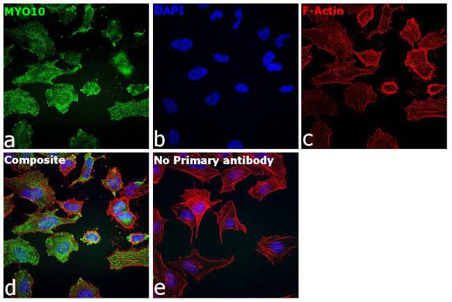 MYO10 Antibody in Immunocytochemistry (ICC/IF)