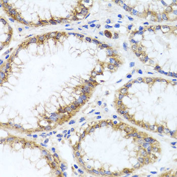 GPM6A Antibody in Immunohistochemistry (Paraffin) (IHC (P))