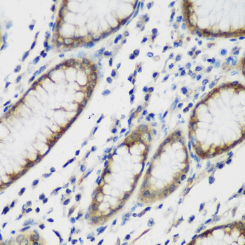 TTBK2 Antibody in Immunohistochemistry (Paraffin) (IHC (P))