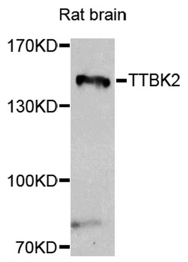 TTBK2 Antibody in Western Blot (WB)