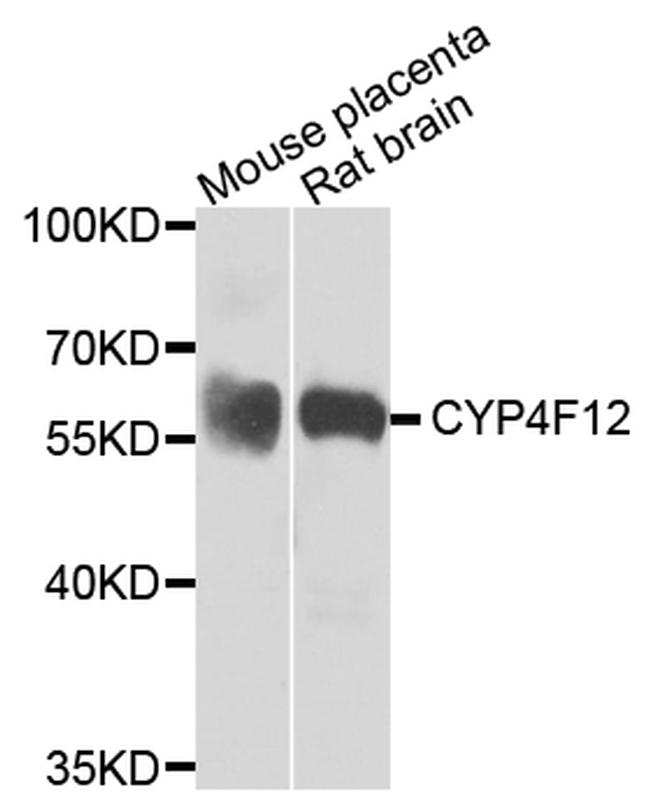CYP4F12 Antibody in Western Blot (WB)