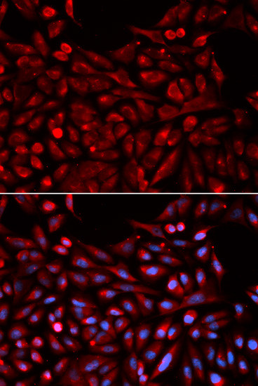 MB67 Antibody in Immunocytochemistry (ICC/IF)