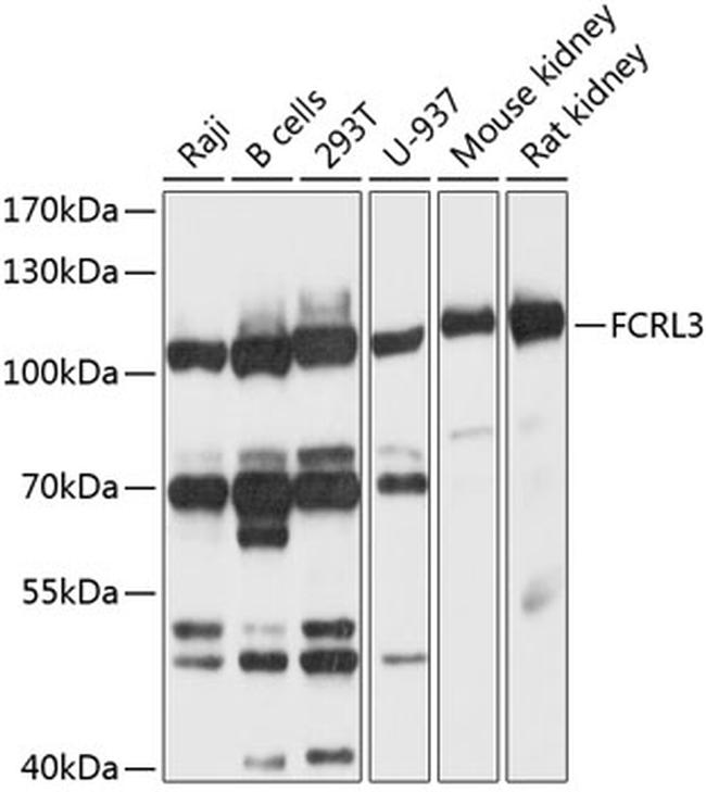 FCRL3 Antibody in Western Blot (WB)