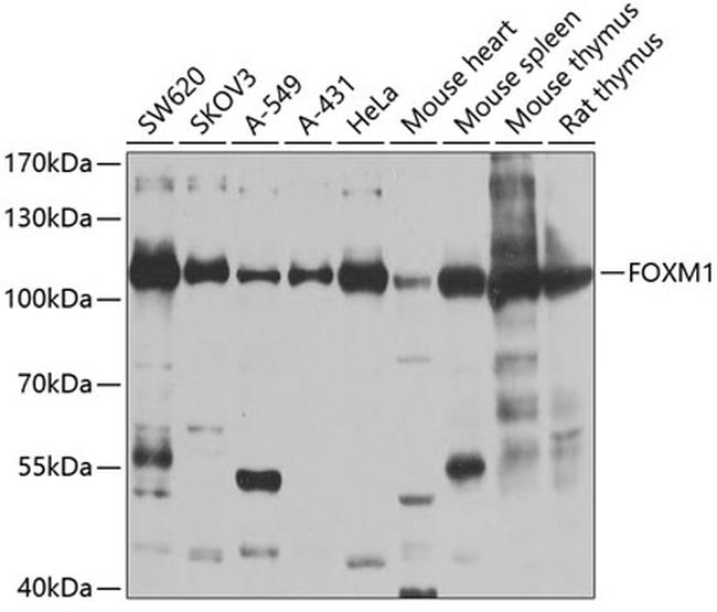 FOXM1 Antibody in Western Blot (WB)