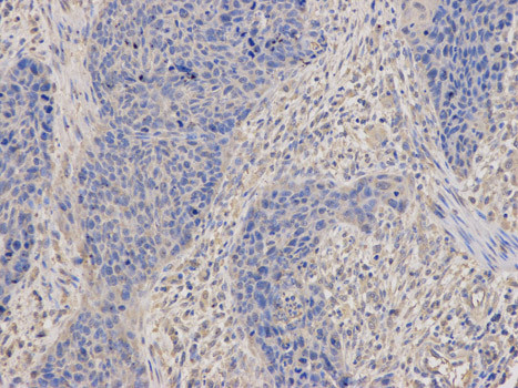 DNM1L Antibody in Immunohistochemistry (Paraffin) (IHC (P))