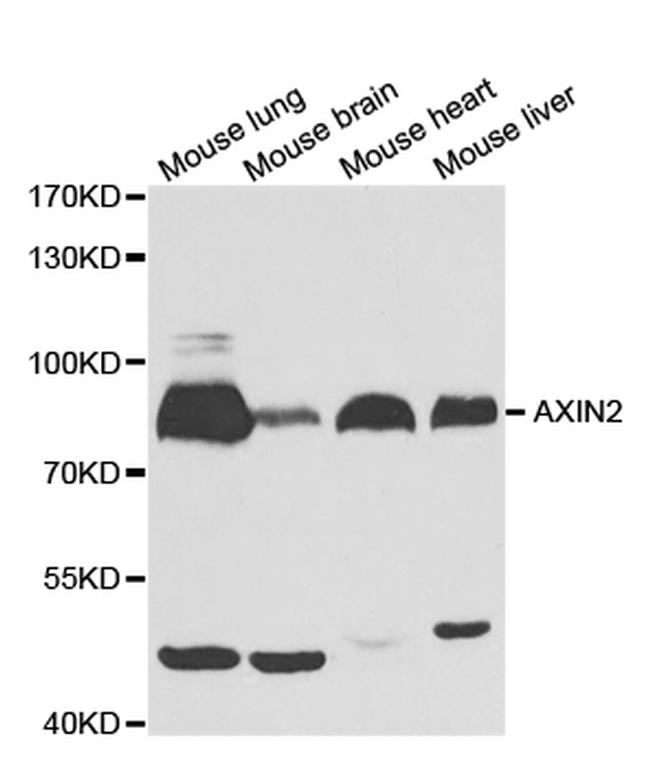 AXIN2 Antibody in Western Blot (WB)