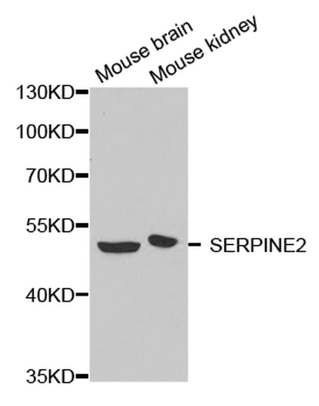 SERPINE2 Antibody in Western Blot (WB)