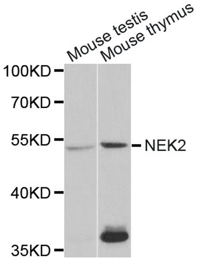 NEK2 Antibody in Western Blot (WB)