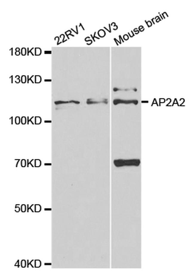 AP2A2 Antibody in Western Blot (WB)