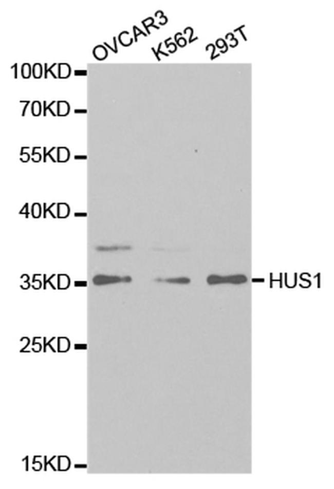 HUS1 Antibody in Western Blot (WB)