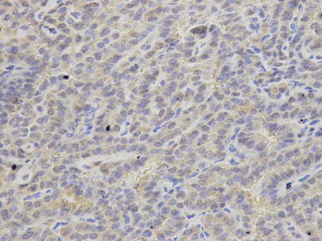 APRT Antibody in Immunohistochemistry (Paraffin) (IHC (P))