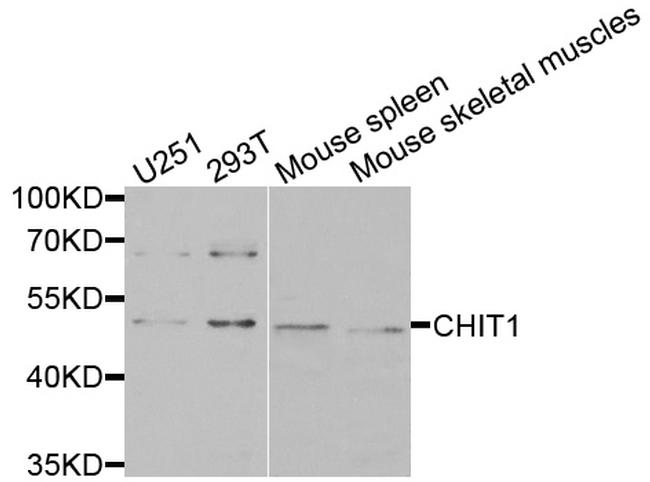 Chitotriosidase Antibody in Western Blot (WB)