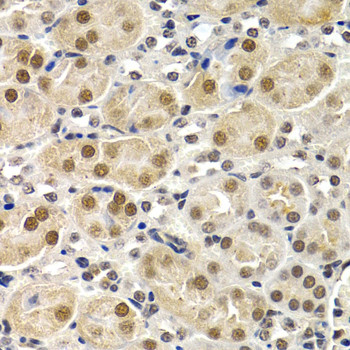 ID3 Antibody in Immunohistochemistry (Paraffin) (IHC (P))