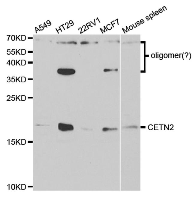 Centrin 2 Antibody in Western Blot (WB)