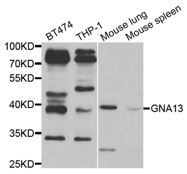 GNA13 Antibody in Western Blot (WB)