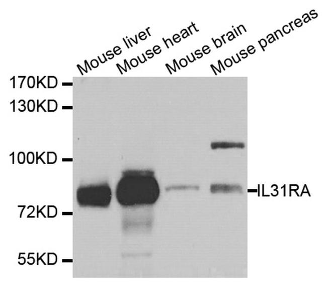 IL31RA Antibody in Western Blot (WB)