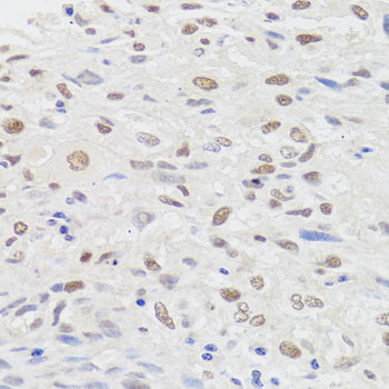 HMGN1 Antibody in Immunohistochemistry (Paraffin) (IHC (P))
