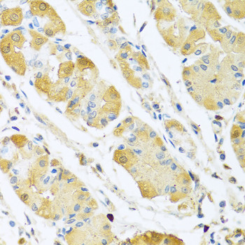 C4BPB Antibody in Immunohistochemistry (Paraffin) (IHC (P))