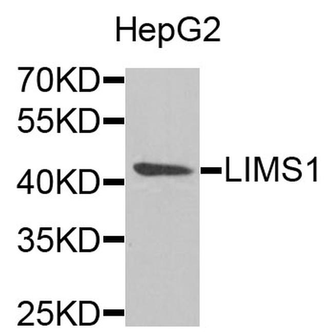 LIMS1 Antibody in Western Blot (WB)