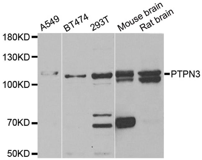 PTPN3 Antibody in Western Blot (WB)