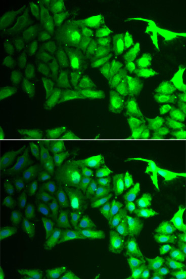 AIPL1 Antibody in Immunocytochemistry (ICC/IF)