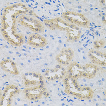 HPS1 Antibody in Immunohistochemistry (Paraffin) (IHC (P))