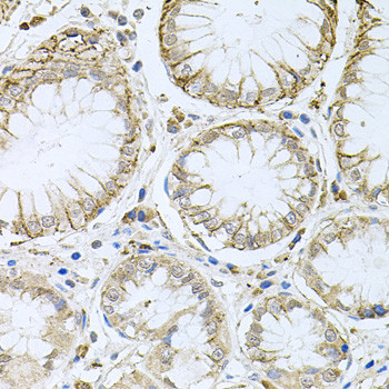 HPS1 Antibody in Immunohistochemistry (Paraffin) (IHC (P))