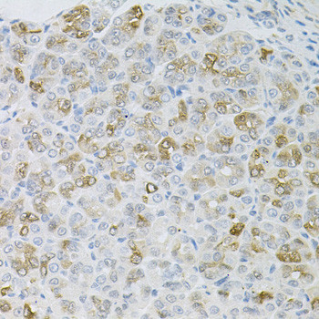 HPS1 Antibody in Immunohistochemistry (Paraffin) (IHC (P))