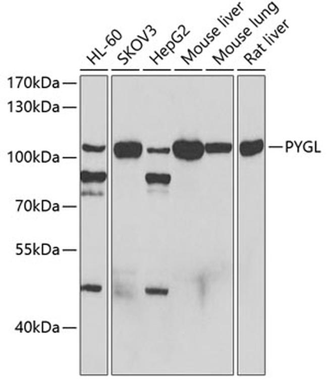 PYGL Antibody in Western Blot (WB)