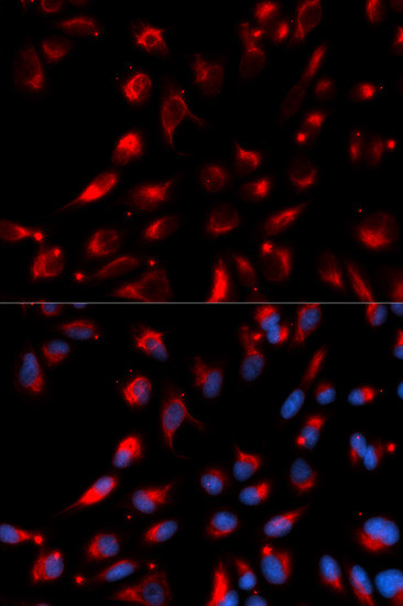 Carboxypeptidase E Antibody in Immunocytochemistry (ICC/IF)