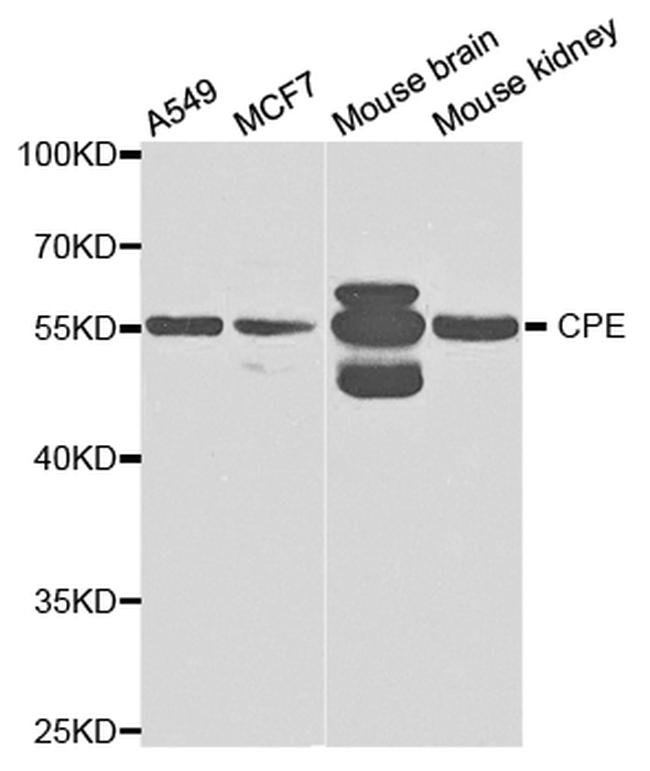 Carboxypeptidase E Antibody in Western Blot (WB)